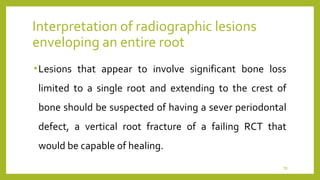 Endo failure | PPT