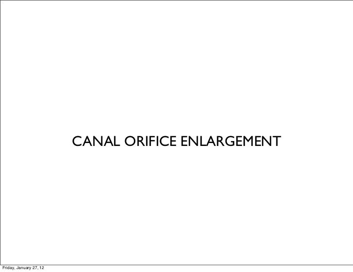 Endo file separation discussion