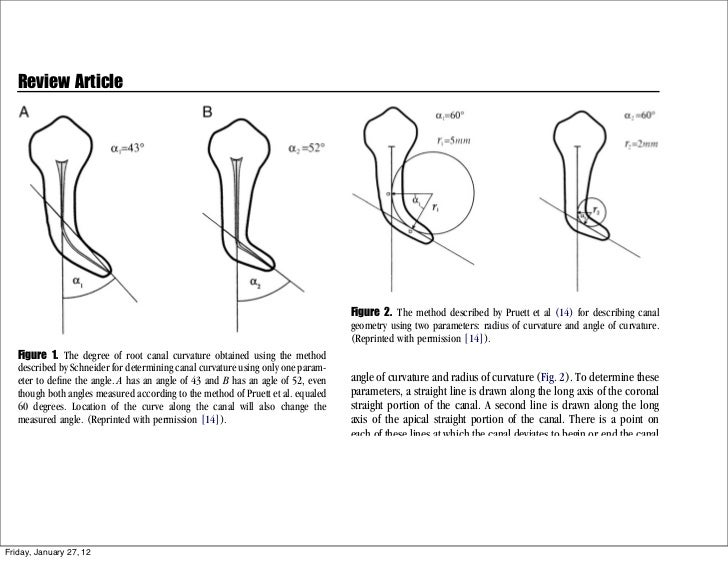 Endo file separation discussion