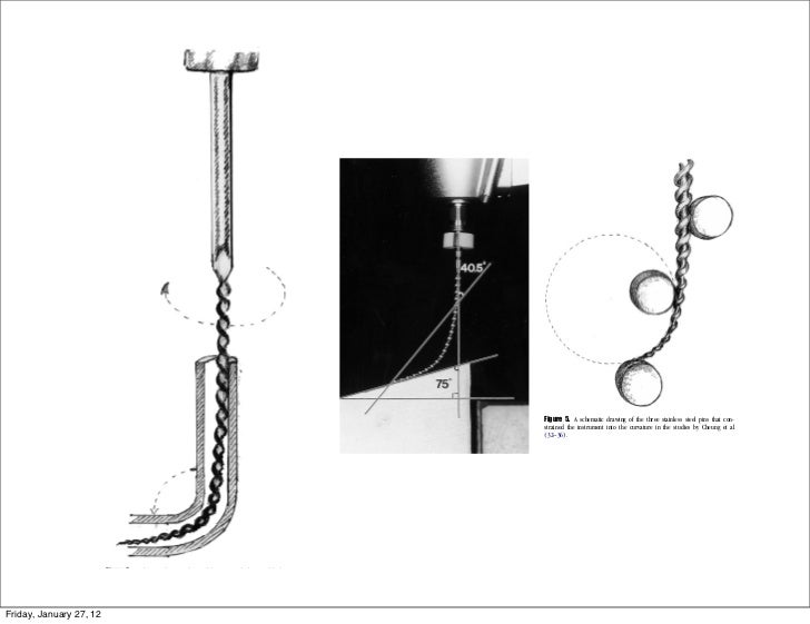 Endo file separation discussion