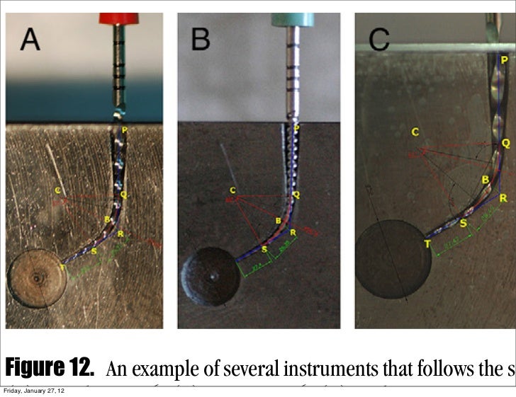 Endo file separation discussion