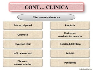 CONT… CLINICA
Otras manifestaciones
Edema palpebral

Proptosis

Quemosis

Restricción
movimientos oculares

Inyección ciliar

Opacidad del vítreo

Infiltrado corneal

Retinitis

Fibrina en
cámara anterior

Periflebitis
Dr. Erilien Cherilus

 