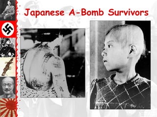 Japanese A-Bomb Survivors
 