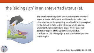 the ‘sliding sign’ in an anteverted uterus (a).
The examiner then places one hand over the woman’s
lower anterior abdomina...