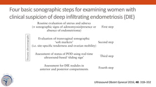 Four basic sonographic steps for examining women with
clinical suspicion of deep infiltrating endometriosis (DIE)
endometr...
