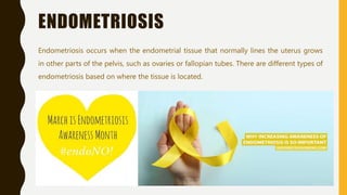 Kidney Endometriosis - Seckin Endometriosis Center