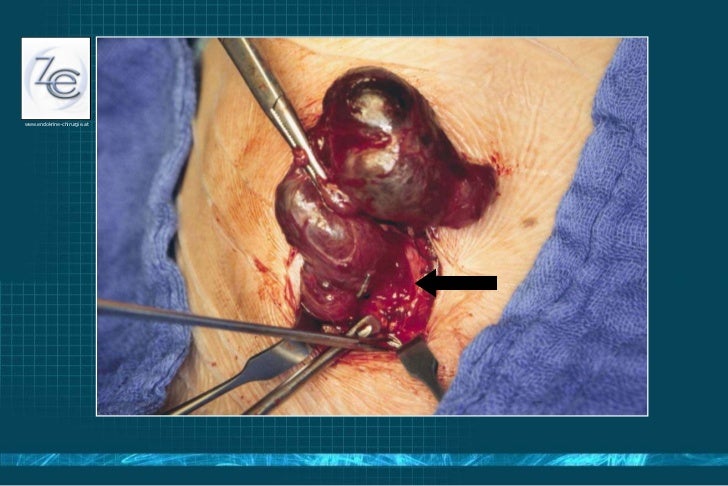 Endokrinchirurgie Update