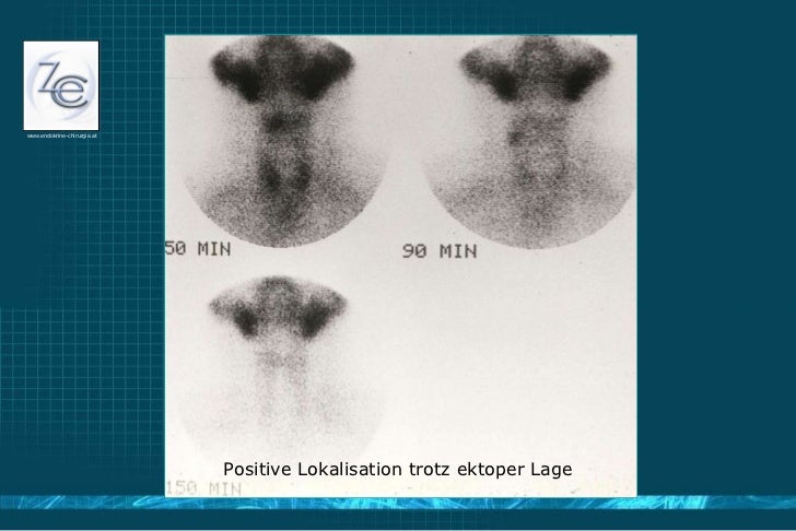 Endokrinchirurgie Update