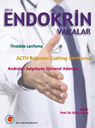 Tiroidde Lenfoma


    ACTH Bağımsız Cushing Sendromu

Androjen Salgılayan Sürrenal Adenom




                                             Editör
                             Prof. Dr. Dilek Yavuz


   ISBN: 000-000-0000-00-0
 