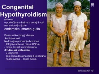 Hipotireoza u područjima u kojima u tlu nema dovoljno joda
- endemska guša .
Danas retko zbog jodiranja kuhinjske soli.
Nedovoljna produkcija hormona utiče na razvoj CNS-a
- može dovesti do kretenizma (. kongenitalni kretenizam)
– danas je Afrika
endemsko područje.
raširena
u područjima u kojima u zemlji I vodi
nema dovoljno joda -
endemska struma-guša
Danas retko zbog jodiranja
kuhinjske soli.
Nedovoljna produkcija hormona
štitnjače utiče na razvoj CNS-a
- može dovesti do kretenizma
(Endemski kretenizam)
u krajevima
gde nema dovoljno joda ili je ishrana
neadekvatna – danas Afrika.
 