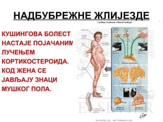 НАДБУБРЕЖНЕ ЖЛИЈЕЗДЕ
КУШИНГОВА БОЛЕСТ
НАСТАЈЕ ПОЈАЧАНИМ
ЛУЧЕЊЕМ
КОРТИКОСТЕРОИДА.
КОД ЖЕНА СЕ
ЈАВЉАЈУ ЗНАЦИ
МУШКОГ ПОЛА.
 