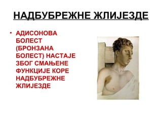 НАДБУБРЕЖНЕ ЖЛИЈЕЗДЕ
• АДИСОНОВА
БОЛЕСТ
(БРОНЗАНА
БОЛЕСТ) НАСТАЈЕ
ЗБОГ СМАЊЕНЕ
ФУНКЦИЈЕ КОРЕ
НАДБУБРЕЖНЕ
ЖЛИЈЕЗДЕ
 