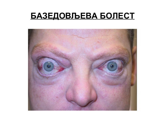 Endokrini sistem