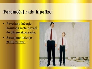 Poremećaj rada hipofize
• Povećano lučenje
hormona rasta dovodi
do džinovskog rasta.
• Smanjeno lučenje-
patuljast rast.
 