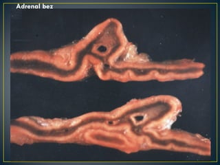 Adrenal bez 