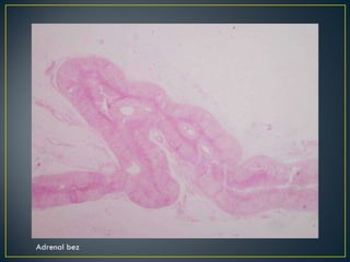 Adrenal bez 
