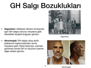 • Gigantizm: Adölesan dönem öncesinde
aşırı GH salgısı sonucu meydana gelir.
Genellikle diyabet bulguları görülür.
• Akromegali: GH salgısı artışı epi
fi
z
plaklarının kapanmasından sonra
meydana gelir. Daha fazla boy uzaması
görülmez ancak GH’un büyüme üzerine
diğer etkileri görülür.
GH Salgı Bozuklukları
Akromegali
Gigantism
85
 