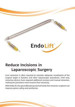 Liver retraction is often required to maintain adequate visualization of the
surgical target in bariatric and other laparoscopic procedures. Until now,
retraction devices have required additional incisions and manual retraction,
making the procedure more invasive than necessary.
With EndoLift, the groundbreaking internal hands-free retractor, surgeons can
improve patient safety and satisfaction.
Reduce Incisions in
Laparoscopic Surgery
 