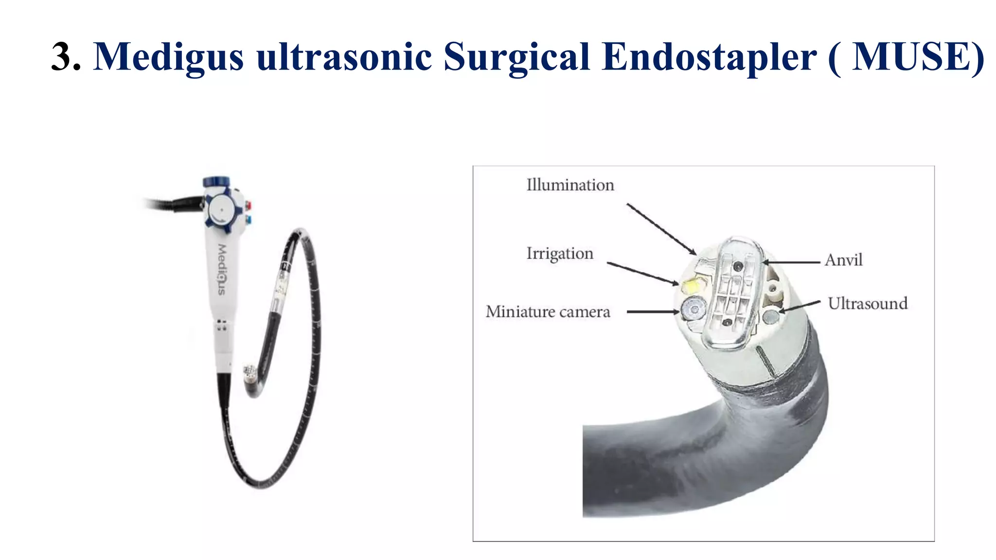 3. Medigus ultrasonic Surgical Endostapler ( MUSE)
 