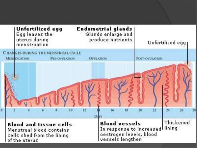 endometrial hyperplasia
