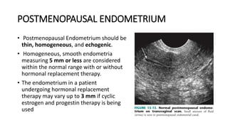 POSTMENOPAUSAL ENDOMETRIUM
• Postmenopausal Endometrium should be
thin, homogeneous, and echogenic.
• Homogeneous, smooth endometria
measuring 5 mm or less are considered
within the normal range with or without
hormonal replacement therapy.
• The endometrium in a patient
undergoing hormonal replacement
therapy may vary up to 3 mm if cyclic
estrogen and progestin therapy is being
used
 