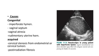 • Causes
Congenital
- imperforate hymen.
- vaginal septum
-vaginal atresia
-rudimentary uterine horn.
acquired
-cervical stenosis from endometrial or
cervical tumors
-postirradiation fibrosis
 