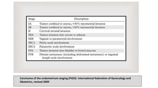 Carcinoma of the endometrium staging (FIGO)- International federation of Gynecology and
Obstetrics, revised 2009
 