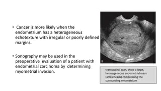 • Cancer is more likely when the
endometrium has a heterogeneous
echotexture with irregular or poorly defined
margins.
• Sonography may be used in the
preoperative evaluation of a patient with
endometrial carcinoma by determining
myometrial invasion. transvaginal scan, show a large,
heterogeneous endometrial mass
(arrowheads) compressing the
surrounding myometrium
 