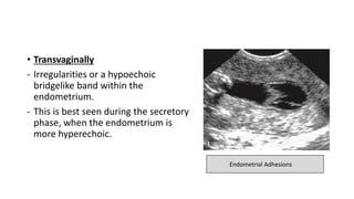 • Transvaginally
- Irregularities or a hypoechoic
bridgelike band within the
endometrium.
- This is best seen during the secretory
phase, when the endometrium is
more hyperechoic.
Endometrial Adhesions
 
