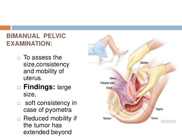 39+ Adnexal Tenderness Exam Images
