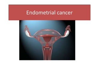 Endometrial cancer
 