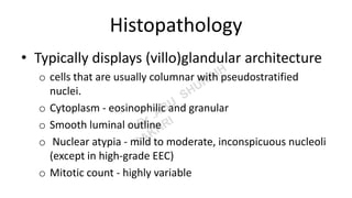 Histopathology
• Typically displays (villo)glandular architecture
o cells that are usually columnar with pseudostratified
nuclei.
o Cytoplasm - eosinophilic and granular
o Smooth luminal outline
o Nuclear atypia - mild to moderate, inconspicuous nucleoli
(except in high-grade EEC)
o Mitotic count - highly variable
 