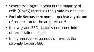 • Severe cytological atypia in the majority of
cells (> 50%) increases the grade by one level
• Exclude Serous carcinoma - nuclear atypia out
of proportion to the architecture!
• In low-grade EEC- Usually endometrioid
differentiation
• In high-grade - squamous differentiation
strongly favours EEC
 
