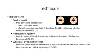 Fallopian Injection Endometrial_Cancer.power point presentation | PPTX