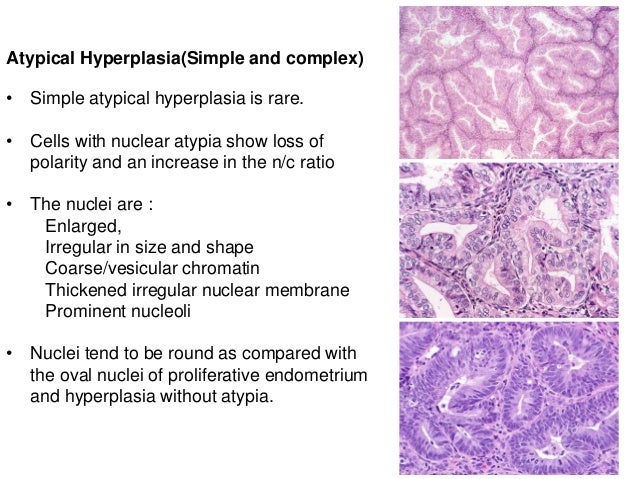 pathology-of-endometrial-hyperplasia-pathology-made-simple