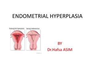 ENDOMETRIAL HYPERPLASIA
BY
Dr.Hafsa ASIM
 