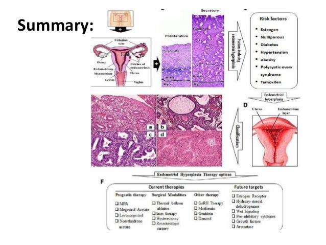 Qué pasa si tengo hiperplasia endometrial