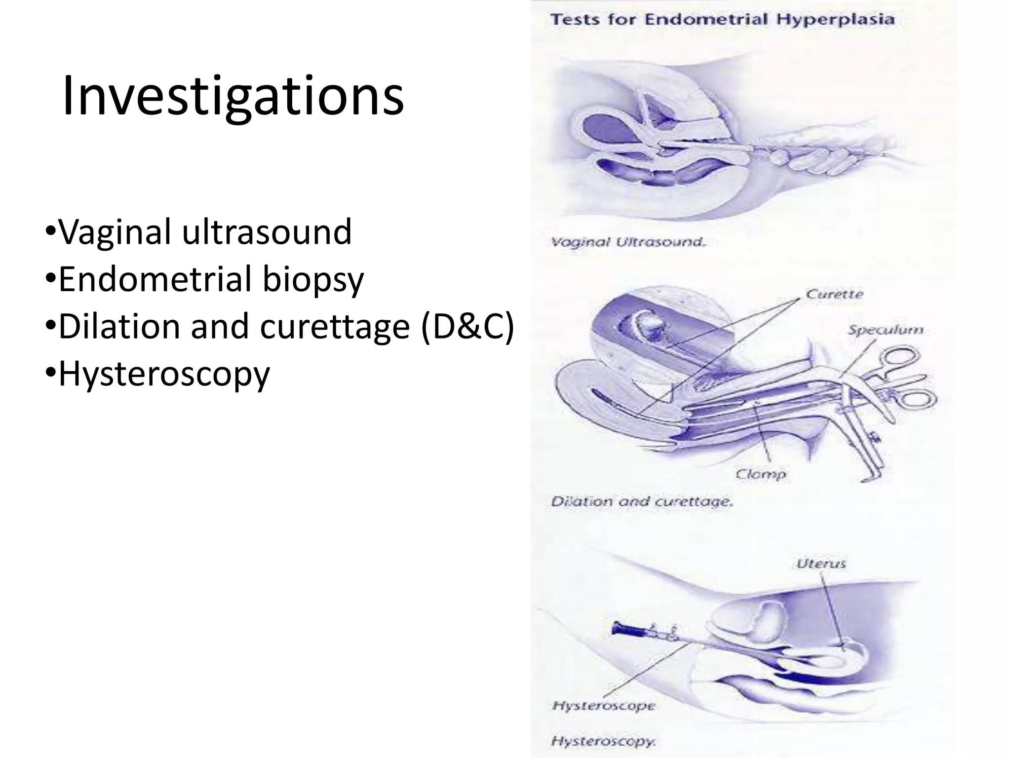 InvestigationsVaginal ultrasound
