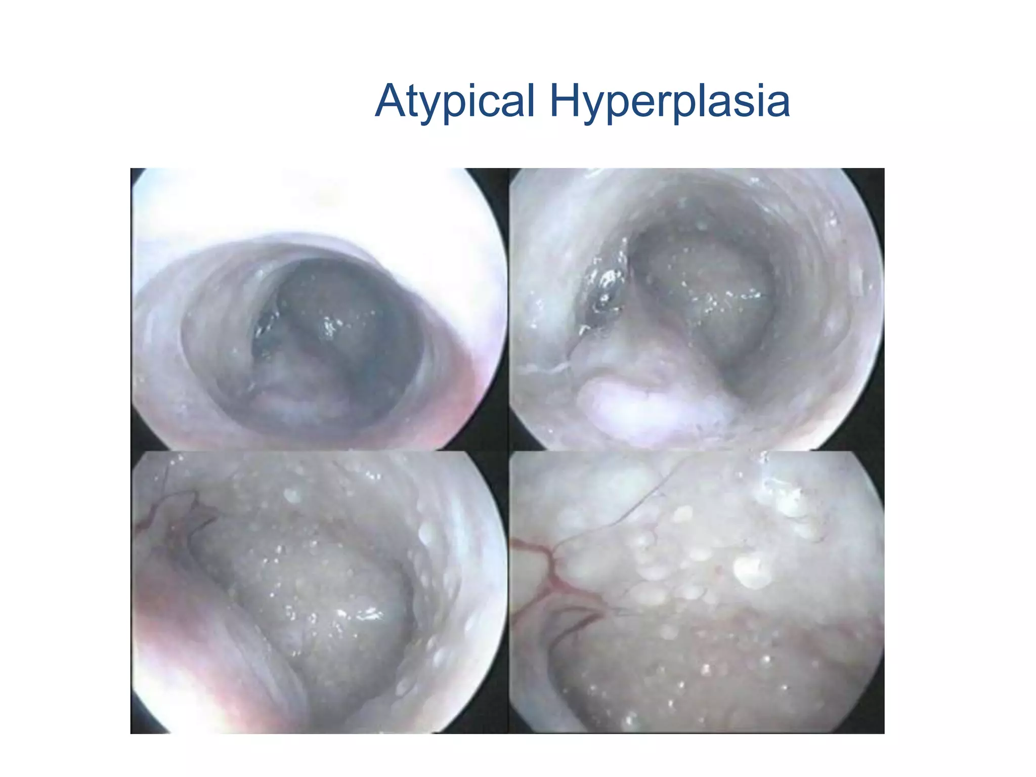 HysteroscopyVaginal ultrasound