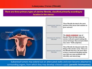 These fibroids develop in the outer
portion of the uterus and continue to
grow outward
Subserosal uterine
fibroids
The most common type of
fibroid. These develop within the
uterine wall and expand making the
uterus feel larger than normal (which
may cause "bulk symptoms)
Intramural uterine
fibroids
These fibroids develop just under the
lining of the uterine cavity. These are
the fibroids that have the most effect
on heavy menstrual bleeding and the
ones that can cause problems with
infertility and miscarriage
Submucosal uterine
fibroids
Leiomyoma, Uterus (Fibroid)
There are three primary types of uterine fibroids, classified primarily according to
location in the uterus:
Subserosal tumors may extend out on attenuated stalks and even become attached to
surrounding organs, from which they may develop a blood supply (parasitic leiomyomas).
 