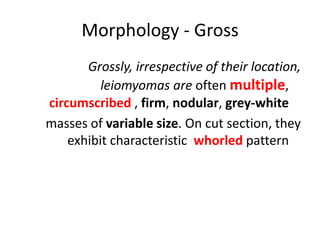 Morphology - Gross
Grossly, irrespective of their location,
leiomyomas are often multiple,
circumscribed , firm, nodular, grey-white
masses of variable size. On cut section, they
exhibit characteristic whorled pattern
 
