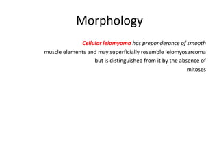 Morphology
Cellular leiomyoma has preponderance of smooth
muscle elements and may superficially resemble leiomyosarcoma
but is distinguished from it by the absence of
mitoses
 