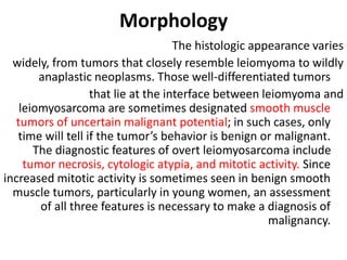 Morphology
The histologic appearance varies
widely, from tumors that closely resemble leiomyoma to wildly
anaplastic neoplasms. Those well-differentiated tumors
that lie at the interface between leiomyoma and
leiomyosarcoma are sometimes designated smooth muscle
tumors of uncertain malignant potential; in such cases, only
time will tell if the tumor’s behavior is benign or malignant.
The diagnostic features of overt leiomyosarcoma include
tumor necrosis, cytologic atypia, and mitotic activity. Since
increased mitotic activity is sometimes seen in benign smooth
muscle tumors, particularly in young women, an assessment
of all three features is necessary to make a diagnosis of
malignancy.
 