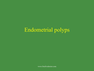 Endometrial polyps www.freelivedoctor.com 