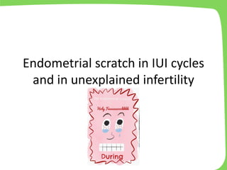 Endometrial scratch in IUI cycles
and in unexplained infertility
 