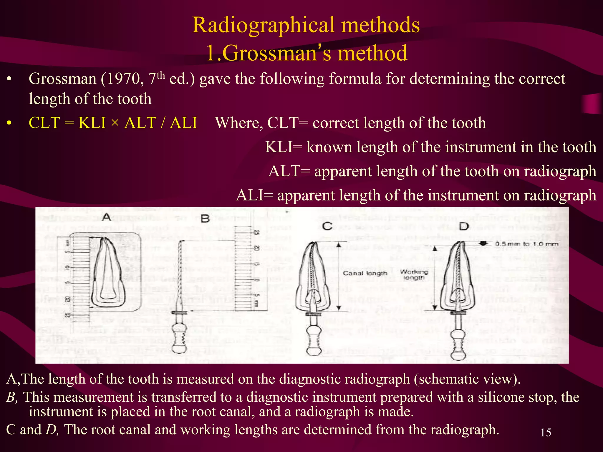 working length estimation in endodontic