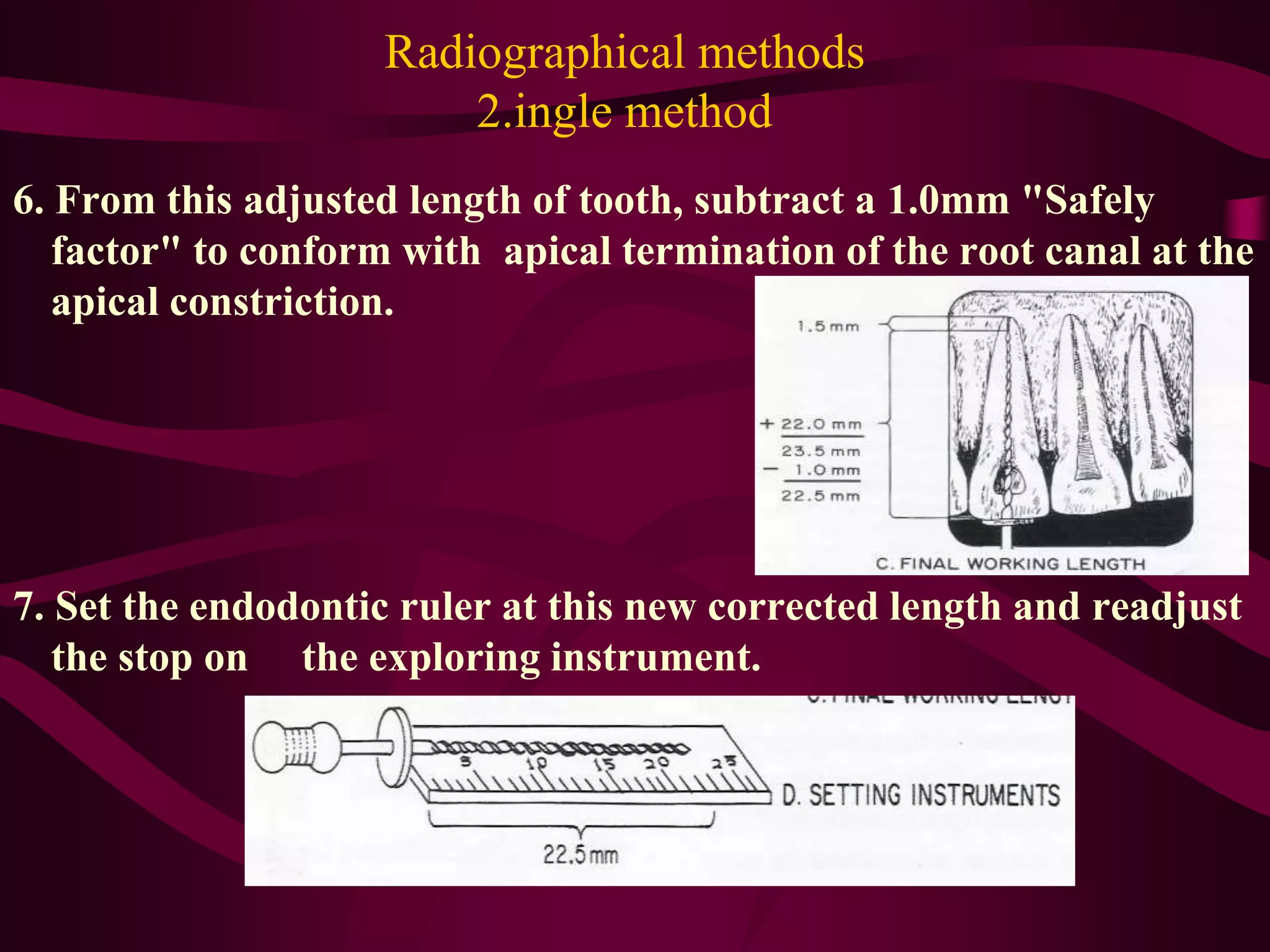 working length estimation in endodontic