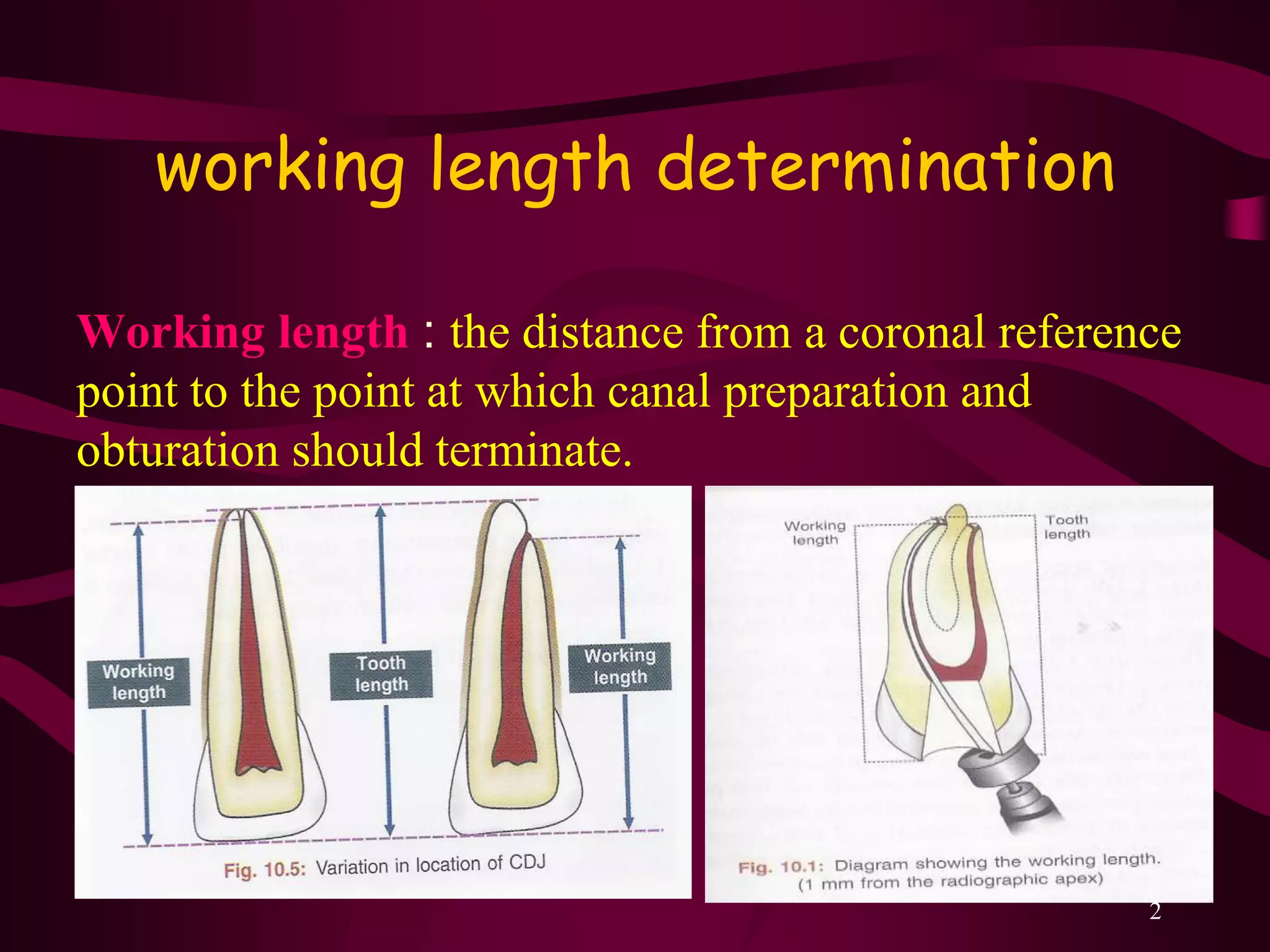 working length estimation in endodontic