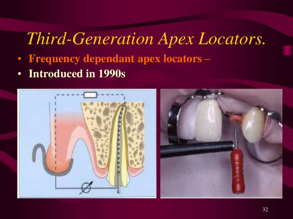 working length estimation in endodontic