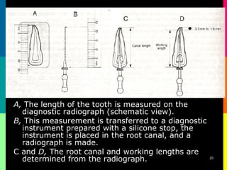 Endo Short Working Length Radiograph Endometrics root canal working length determination | PPT